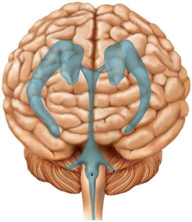 ventricle Lateral aperture Median aperture Central canal Cerebrum Lateral ventricle Interventricular foramen