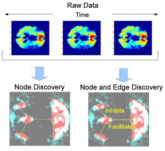 Tensor Imaging Analysis Brain Network Discovery 1. Node discovery 2. Edge discovery 3.