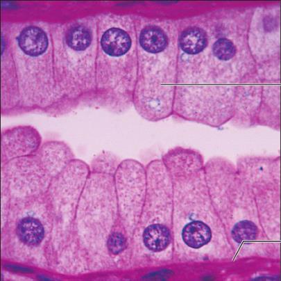 SIMPLE COLUMNAR EPITHELIUM One layer of tall, thin cells Perform complex functions, movement, and secretion May have cilia or microvilli Some cells