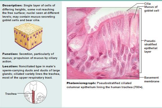 PSEUDOSTRATIFIED