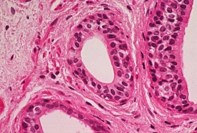 STRATIFIED CUBOIDAL EPITHELIUM More than one layer (stratified) of cuboidal epithelial cells Functions are
