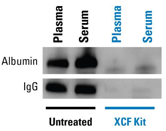 Example Data and Applications Figure 1. Workflow summary of XCF TM COMPLETE Exosome & cfdna Isolation Kit for complete DNA isolation from serum and plasma biofluids Figure 2.