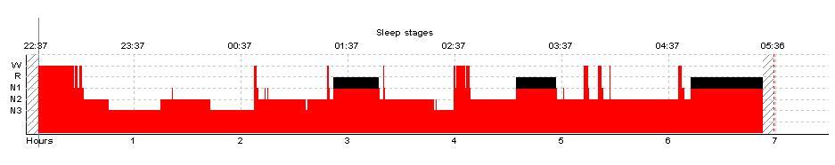 Kirsch et al 2016 Sleep stages and architecture: W (wake) R