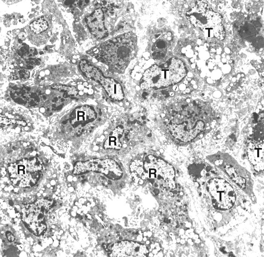 382 Liver Stem Cells Figure 5. Different types of immature liver cells [9, 10].