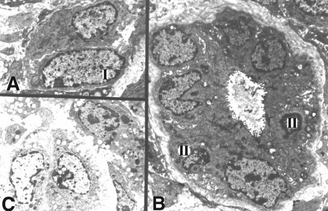 B) Type II, bile duct-like cells located in duct. These are more differentiated than those described by Roskams et al. [10] and by Novikoff et al. [16] and are only seen within ducts.