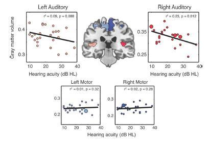 auditory cortex Demonstrated in