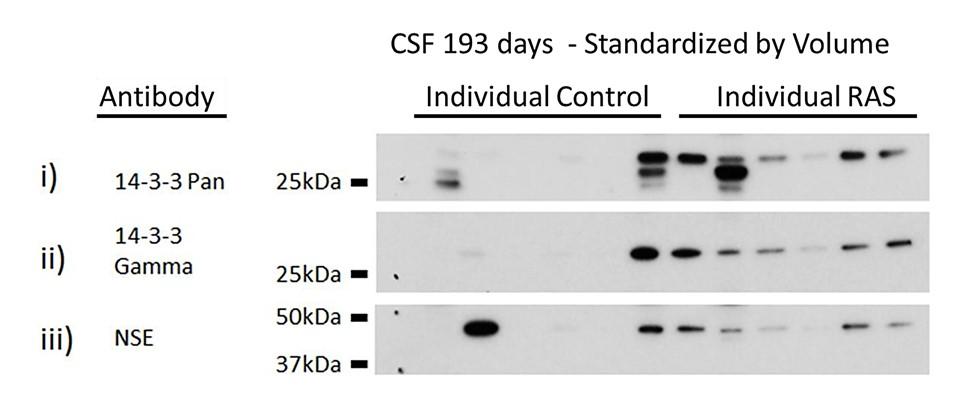 A) B) C) Figure 2-2. Individual characterization of 14-3-3 and NSE in rat-adapted scrapie (RAS) infection standardized by volume.