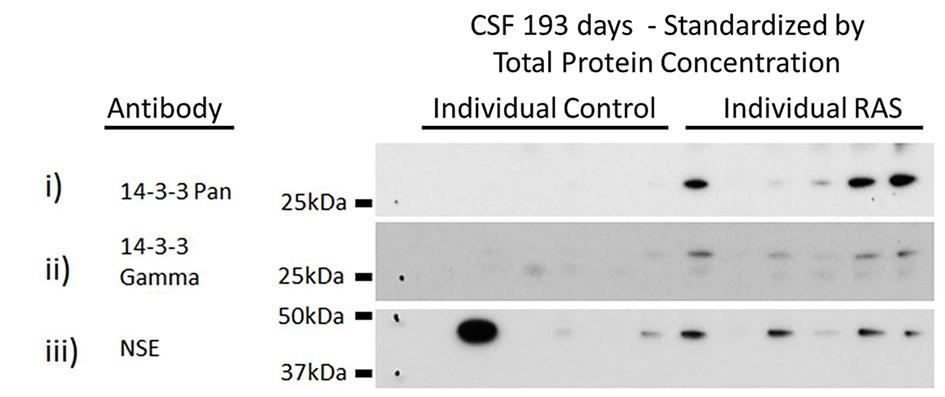 A) B) C) Figure 2-3. Individual characterization of 14-3-3 and NSE in rat-adapted scrapie (RAS) infection standardized by total protein concentration.