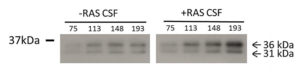 Figure 3-1. RNase T2 Abundance in CSF is elevated in prion infected rats.