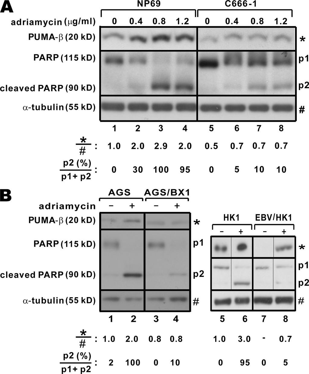 ARTICLE of PUMA expression, it should prevent the accumulation of PUMA protein in both C666-1 and AGS/BX1 cells.