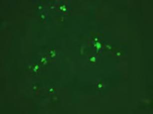 DCF staining for MCF-7/WT cells treated with hydrogen peroxide and sildenafil H2O2 2µM 1h Sildenafil