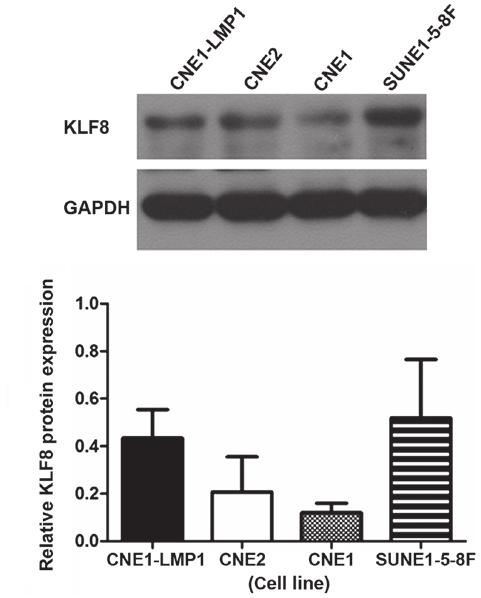 ONCOLOGY LETTERS 9: 2515-2519, 2015 2517 Expression of KLF8 in the SUNE1 5 8F cell line is significantly downregulated by the pgcsil GFP KLF8 lentiviral vector.