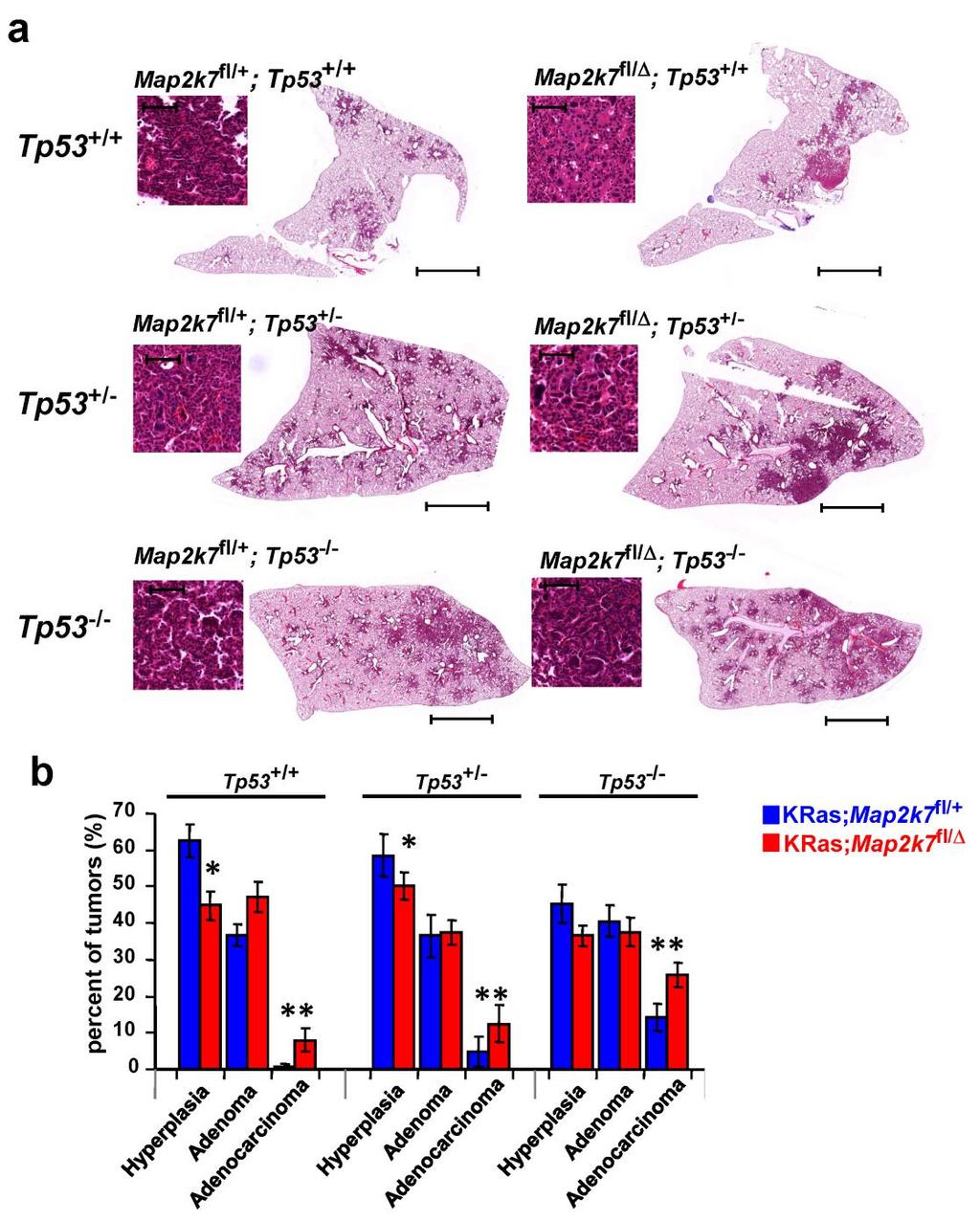 Supplementary Figure 10. MKK7 deficiency does not alter tumor burden but tumor grading in a p53 negative background.