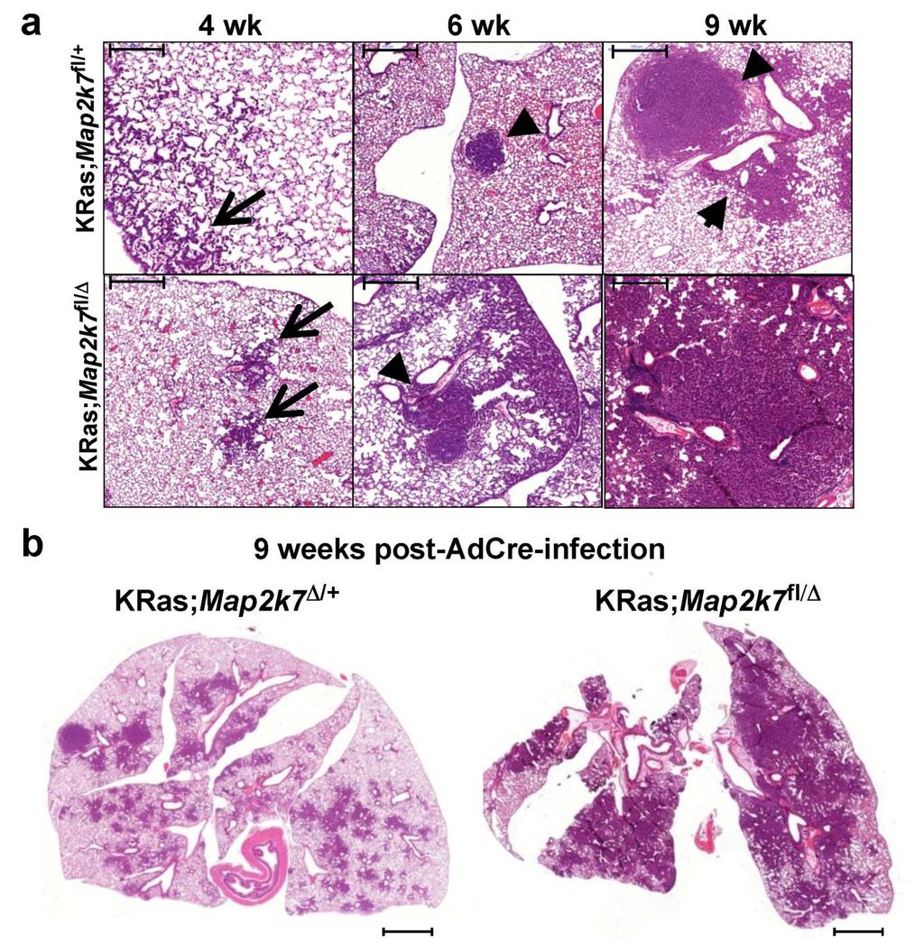 Supplementary Figure 2. Loss of MKK7 accelerates KRas G12D -driven lung cancer.