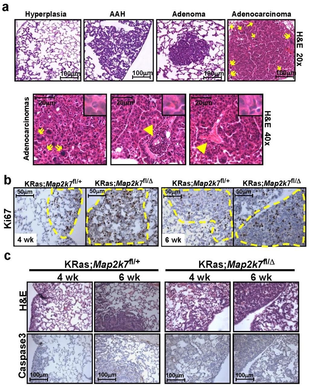 Supplementary Figure 3. Enhanced proliferation in MKK7 mutant lung tumors.