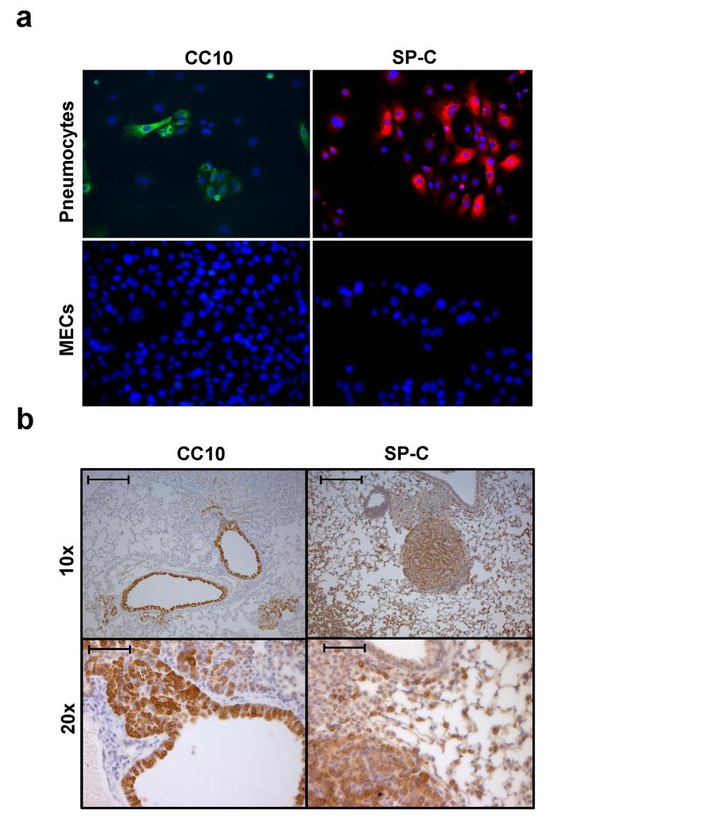 Supplementary Figure 5. Characterisation of primary pneumocytes cultures and KRas V12D -driven lung tumors.