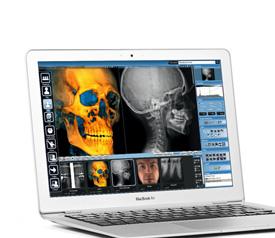 Planmeca Romexis World-leading imaging software Planmeca Romexis is an