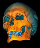 supporting: - CBCT images, 3D photos, STL surface data - Panoramic,