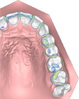 Planmeca Romexis 3D Ortho Studio Innovative applications for orthodontists