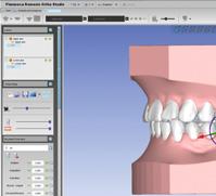 dental models scanned with Planmeca ProMax 3D X-ray units or the Planmeca