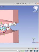 Dental cast analysis tools for the examination of space, tooth size, cross
