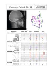 treatment planning and for creating cephalometric analyses and superimpositions.