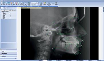 frontal and arch), and superimpositions Customisable analyses, standard values, reports,