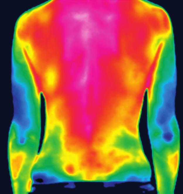 Infrared camera that allows easy location of the inﬂamed areas, in