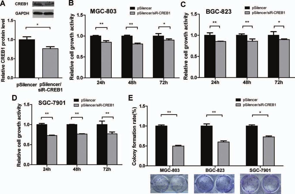 MIR-181B TARGETS CREB1 IN GASTRIC CANCER 633 Figure 4. Knockdown of CREB1 inhibits cell growth in gastric adenocarcinoma cell lines.