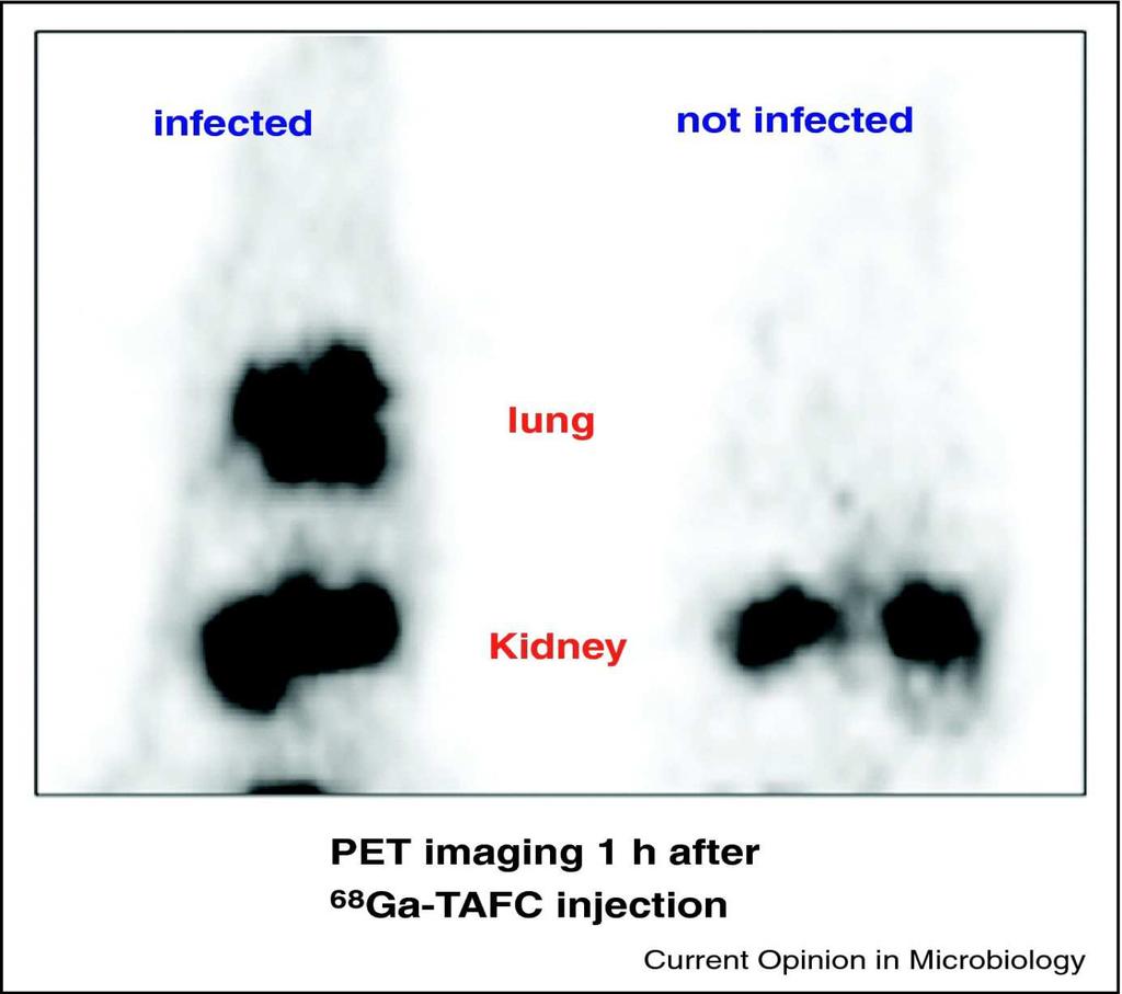 Fungal Iron acquisition as a diagnostic tool PET imaging of invasive pulmonary aspergillosis in a rat model using 68 Ga-TAFC.