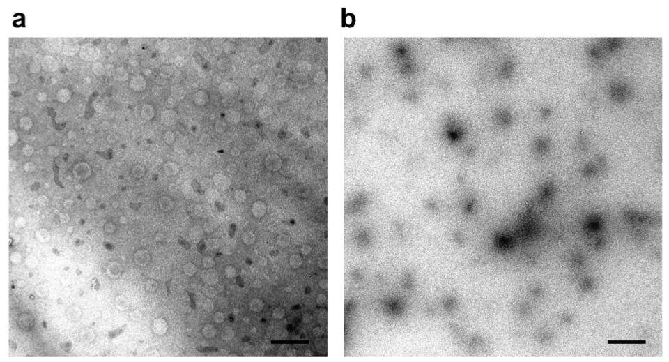2. Morphological analysis of S/O nanodispersions carrying K-TRP-2 peptide Figure S2.