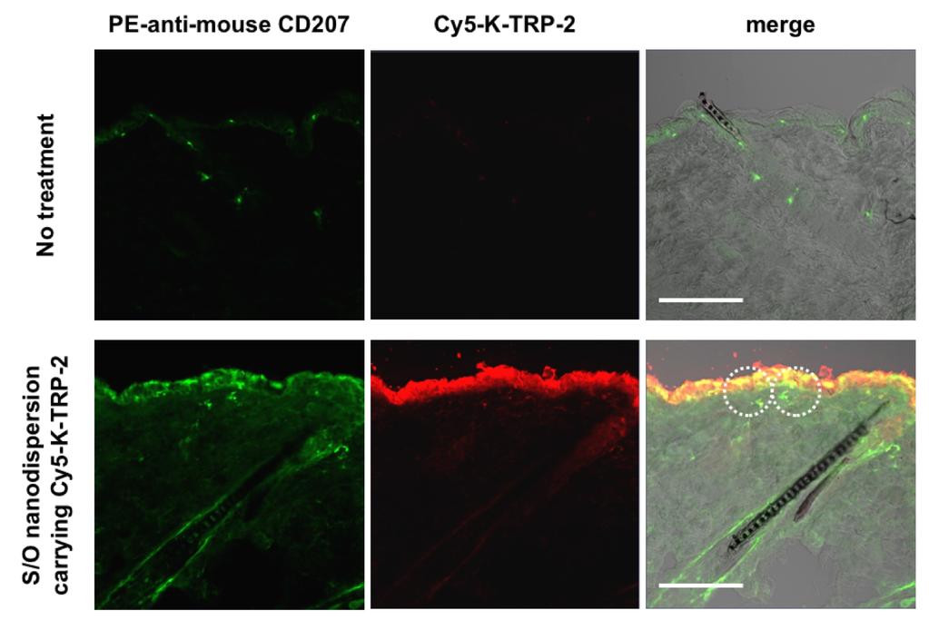 11. Transcutaneous delivery of K-TRP-2 peptide to Langerhans cells K-TRP-2 peptide was labeled with Cy5 using Cy5 monofunctional reactive dye (GE healthcare UK Ltd.).
