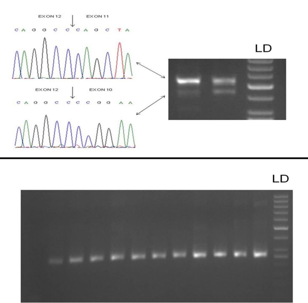 RESULTS Transcript analysis Sanger sequencing Exon 7-8 x 13 gave a major fragment of 526 bp in the six cdna samples that corresponded to the full IL17RA transcript A very faint band of approximately