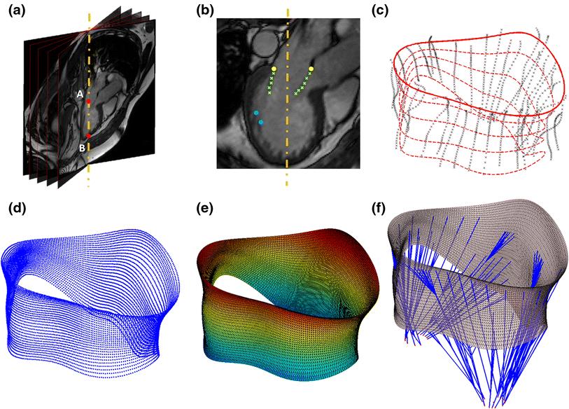 Image Processing and MV 3D Geometrical Model Software developed in MATLAB (The MathWorks Inc.