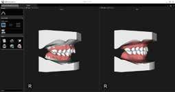 ORTHODONTICS CS MODEL Eliminate the cost and hassle of plaster models with CS Model.