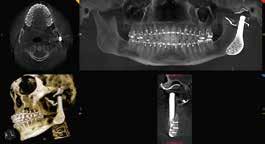 Orthodontic QUICK AND PRECISE ORTHODONTIC IMAGERY