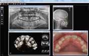 A complete set of tools for viewing, processing and annotating CBCT volumes. Patient database: Access patient images and CAD/CAM data through one patient database.