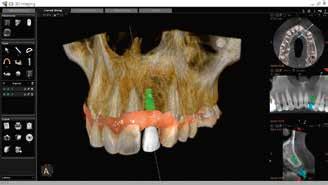 Our solutions and add-on software are designed to address your specific needs in implant planning, orthodontic applications and CAD/CAM