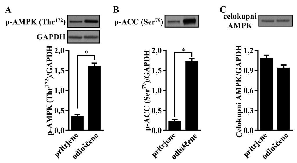 Bizjak, M. Vpliv metformina na rakave celice v kulturi v odvisnosti od razpoložljivih hranil.