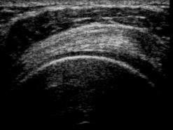 Grayscale appearance on ultrasound. A starting point on a linear scale.