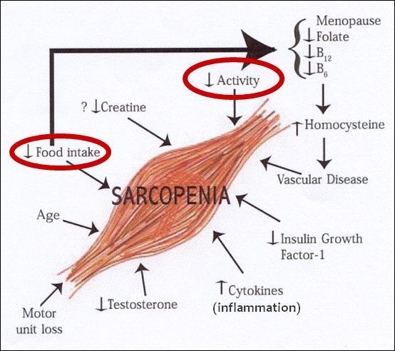 Categories of Sarcopenia by Cause Cruz-Jentoft et