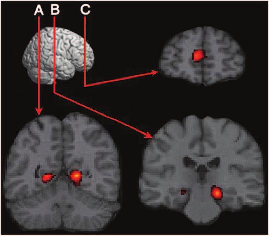 A Basic-Systems Approach to Autobiographical Memory Fig. 1. Activation in brain areas during an autobiographical memory experiment.