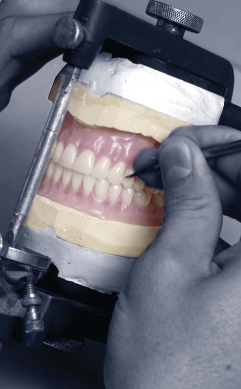 REMOVABLE PROSTHETICS ORTHODONTIC SERVICES Group Practice Select Full Dentures Our most popular complete denture includes the Dentsply s Lucitone 199 acrylic, and heat cured IPN denture teeth.