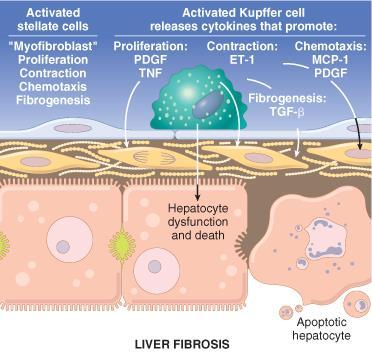 Fibrosis Increased amount of connective tissue within the liver Ito (stellate)