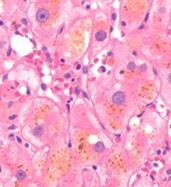 Yellowish/greenish brown liver Histo Bile in canaliculi &