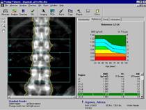 Physician Brochure Sunday, October 25th, 2015 OAR Canadian Bone Mineral Densitometry Physician Workstation CME 2015 Course Director: This course will be of interest to Radiologists and other
