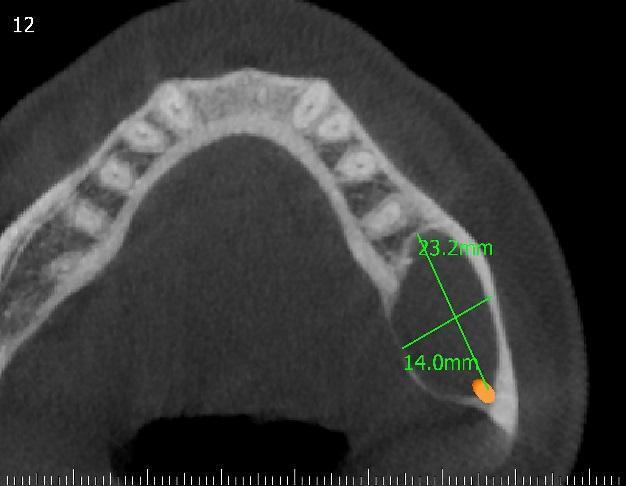 4(c): CBCT- Sections