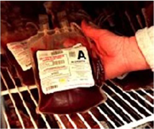 Risks of Blood Transfusion