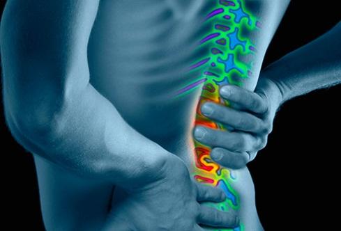 Chronic Low Back Pain Seminar Patient