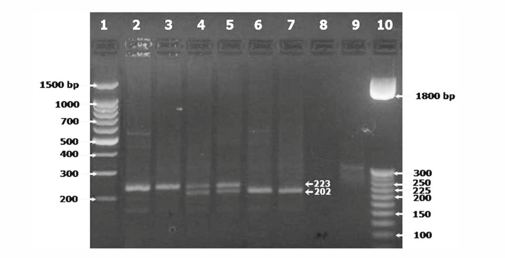 Figure 1. Identification of the -590 Polymorphism of the 5 Flanking Region of the IL4 Gene by Restriction Fragment-Length Assay.